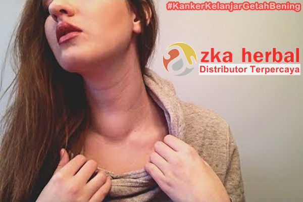 Obat Herbal Kanker Kelenjar Getah Bening Paling Ampuh