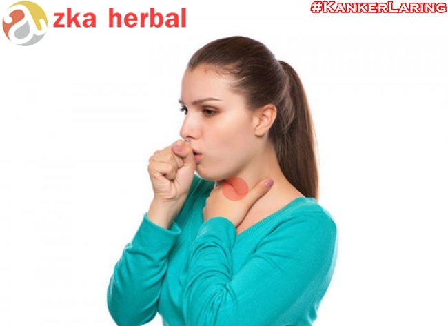 Obat Herbal Kanker Laring Paling Ampuh 100% Tanpa Operasi